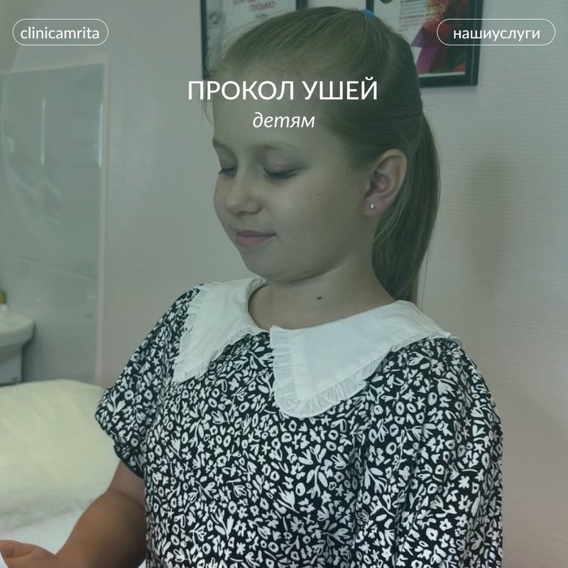 Прокол ушей детям