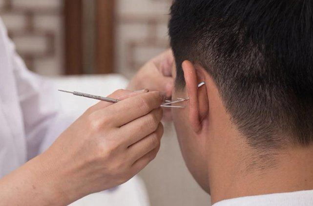 Иглоукалывание от курения